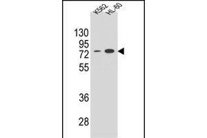 ENTPD3 Antibody (C-term) (ABIN654673 and ABIN2844368) western blot analysis in K562 and HL-60 cell line lysates (35 μg/lane). (ENTPD3 抗体  (C-Term))