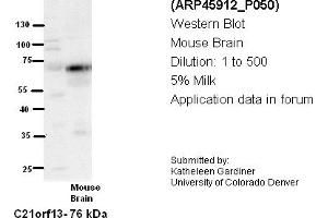 Image no. 2 for anti-Leber Congenital Amaurosis 5-Like (LCA5L) (N-Term) antibody (ABIN2782411) (LCA5L 抗体  (N-Term))
