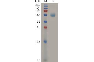 Mouse GITR Protein, hFc Tag on SDS-PAGE under reducing condition.