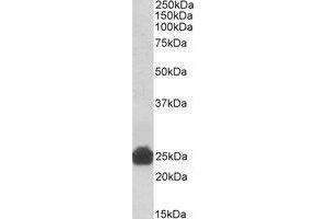 AP23667PU-N GSTA5 antibody staining of Rat Liver lysate at 0. (GSTa5 抗体  (Internal Region))