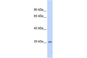 WB Suggested Anti-PSME1 Antibody Titration: 0. (PSME1 抗体  (Middle Region))