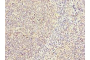 Immunohistochemistry of paraffin-embedded human tonsil tissue using ABIN7146507 at dilution of 1:100 (CAMSAP2 抗体  (AA 1-150))