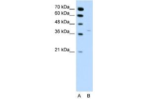 HSD17B1 antibody used at 0. (HSD17B1 抗体)