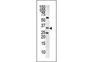 Western Blotting (WB) image for anti-CTD (Carboxy-terminal Domain, RNA Polymerase II, Polypeptide A) Small Phosphatase 1 (CTDSP1) (AA 235-261), (C-Term) antibody (ABIN392888)