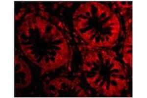 Immunofluorescence of TEM1 in Human Colon cells with TEM1at 20 µg/ml. (CD248 抗体  (C-Term))