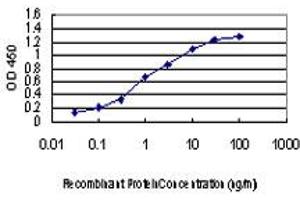 Detection limit for recombinant GST tagged IRAK2 is approximately 0. (IRAK2 抗体  (AA 111-210))