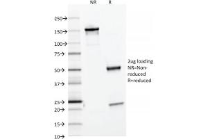 SDS-PAGE Analysis Purified Ferritin, Light Chain Mouse Monoclonal Antibody (FTL/1386). (FTL 抗体  (AA 38-165))