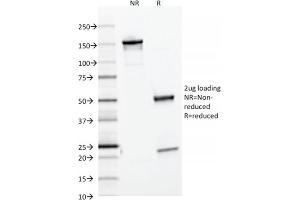SDS-PAGE Analysis Purified Ferritin, Light Chain Mouse Monoclonal Antibody (FTL/1386). (FTL 抗体  (AA 38-165))