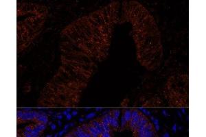 Immunofluorescence analysis of Human colon carcinoma cells using MUC2 Polyclonal Antibody at dilution of 1:100. (MUC2 抗体)