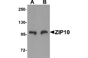 Western Blotting (WB) image for anti-Solute Carrier Family 39 (Zinc Transporter), Member 10 (SLC39A10) (Middle Region) antibody (ABIN1031176) (SLC39A10 抗体  (Middle Region))