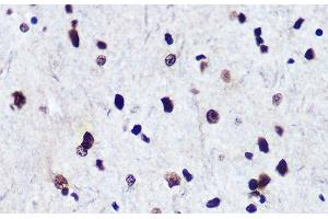 Immunohistochemistry (Paraffin-embedded Sections) (IHC (p)) image for anti-SMAD, Mothers Against DPP Homolog 2 (SMAD2) (pSer423), (pSer425), (pSer465), (pSer467) antibody (ABIN7265256)