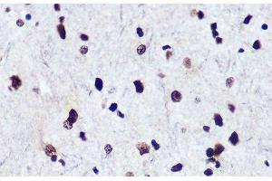 Immunohistochemistry of paraffin-embedded Rat brain using Phospho-Smad2(S465/467)/Smad3(S423/425) Polyclonal Antibody at dilution of 1:100 (40x lens).