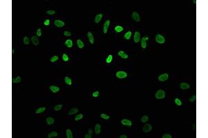 Immunofluorescence staining of Hela cells with ABIN7139182 at 1:7. (HIST1H3A 抗体  (acLys4))