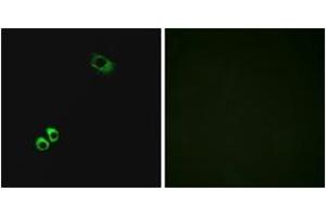 Immunofluorescence analysis of MCF7 cells, using GPRC6A Antibody. (GPRC6A 抗体  (AA 471-520))
