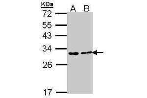 WB Image Sample (30 ug of whole cell lysate) A: A431 , B: H1299 12% SDS PAGE antibody diluted at 1:1000 (FKBP3 抗体  (Center))