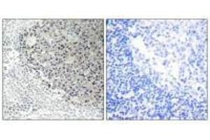 Immunohistochemistry analysis of paraffin-embedded human tonsil tissue using Collagen IX α3 antibody. (COL9A3 抗体)