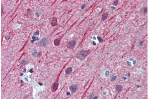 Human Brain, Cortex: Formalin-Fixed, Paraffin-Embedded (FFPE) (TUBB2A 抗体  (AA 1-446))