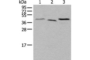 Western blot analysis of Mouse brain tissue Hela and HEPG2 cell lysates using UBXN1 Polyclonal Antibody at dilution of 1:500 (UBXN1 抗体)