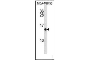 Western blot analysis of CRABP2 Antibody (C-term) Cat. (CRABP2 抗体  (C-Term))