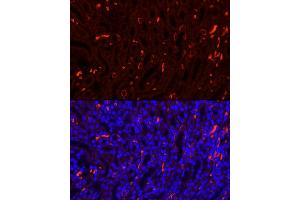 Immunofluorescence analysis of Mouse kidney using SLC4 antibody (7391 ) at dilution of 1:100. (Band 3/AE1 抗体  (AA 1-353))