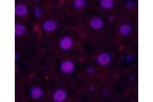 Immunofluorescence analysis of Rat liver tissue using Cleaved-CASP3 p17 (D175) Polyclonal Antibody at dilution of 1:200. (Caspase 3 p17 (Cleaved-Asp175) 抗体)