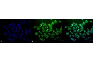 Immunocytochemistry/Immunofluorescence analysis using Mouse Anti-Ubiquitin Monoclonal Antibody, Clone 6C11-B3 (ABIN361817 and ABIN361816). (Ubiquitin 抗体)