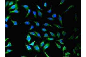 Immunofluorescence (IF) image for anti-Sorting Nexin 9 (SNX9) (AA 85-200) antibody (ABIN7170408)