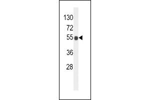 Western Blotting (WB) image for anti-UDP-GlcNAc:betaGal beta-1,3-N-Acetylglucosaminyltransferase 6 (Core 3 Synthase) (B3GNT6) (AA 146-173) antibody (ABIN653842)