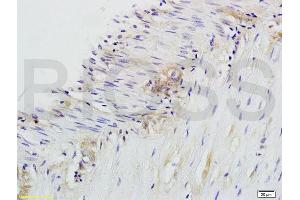 Formalin-fixed and paraffin embedded rat colitis labeled with Anti-CD28 Polyclonal Antibody, Unconjugated (ABIN674604) at 1:200 followed by conjugation to the secondary antibody and DAB staining. (CD28 抗体  (AA 1-120))