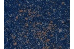DAB staining on IHC-P; Samples: Mouse Lymph node Tissue (COL1A1 抗体  (AA 1225-1453))