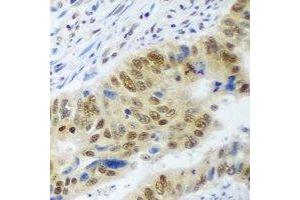Immunohistochemical analysis of WDR48 staining in human colon formalin fixed paraffin embedded tissue section.