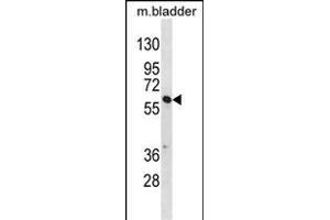 SNX30 Antibody (C-term) (ABIN1537180 and ABIN2849996) western blot analysis in mouse bladder tissue lysates (35 μg/lane). (SNX30 抗体  (C-Term))