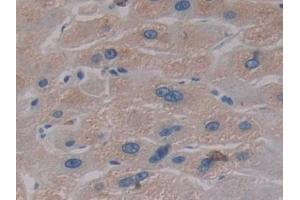 Detection of PKBb in Human Liver Tissue using Polyclonal Antibody to Protein Kinase B Beta (PKBb) (AKT2 抗体  (AA 142-412))