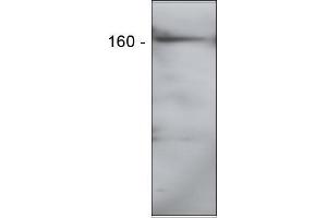 Western Blotting (WB) image for anti-Elastin Microfibril Interfacer 2 (EMILIN2) antibody (ABIN952078) (EMILIN2 抗体)