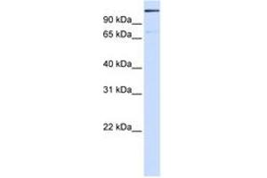 Image no. 1 for anti-Tankyrase 1 Binding Protein 1, 182kDa (TNKS1BP1) (AA 1512-1561) antibody (ABIN6744262) (TNKS1BP1 抗体  (AA 1512-1561))