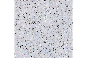 IHC analysis of SF3B3 using anti-SF3B3 antibody (ABIN7602378).