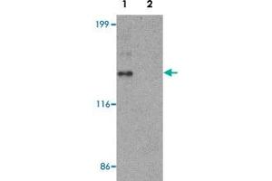 Western blot analysis of HeLa cell lysate with ZNF521 polyclonal antibody  at 1 ug/mL in (1) the absence and (2) the presence of blocking peptide. (ZNF521 抗体  (N-Term))