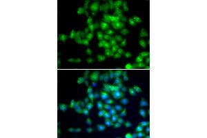Immunofluorescence analysis of MCF-7 cells using SIRT3 antibody (ABIN5974409). (SIRT3 抗体)
