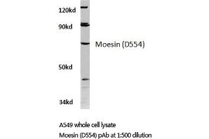 Western blot (WB) analysis of Moesin antibody in extracts from A549 cells. (Moesin 抗体)