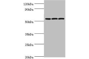 Western blot All lanes: Alpha-amylase 2B antibody at 8 μg/mL Lane 1: Mouse skeletal muscle tissue Lane 2: HL60 whole cell lysate Lane 3: K562 whole cell lysate Secondary Goat polyclonal to rabbit IgG at 1/10000 dilution Predicted band size: 58, 43 kDa Observed band size: 58 kDa (AMY2B 抗体  (AA 16-320))