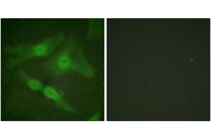 Immunofluorescence analysis of HeLa cells, using PKC zeta (Phospho-Thr410) Antibody. (PKC zeta 抗体  (pThr410))