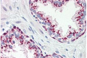 Human Prostate (formalin-fixed, paraffin-embedded) stained with Heat Shock Protein 70 (HSP70) antibody ABIN364327 at 10 ug/ml followed by biotinylated anti-mouse IgG secondary antibody ABIN481714, alkaline phosphatase-streptavidin and chromogen. (HSP70 抗体  (AA 1-641))