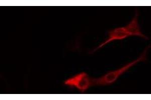 ABIN6274816 staining LOVO cells by IF/ICC. (ARF4 抗体  (Internal Region))