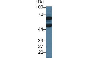 Western Blot; Sample: Porcine Cerebrum lysate; Primary Ab: 3µg/ml Rabbit Anti-Human DBR1 Antibody Second Ab: 0. (DBR1 抗体  (AA 243-372))