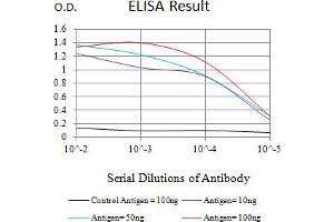 Black line: Control Antigen (100 ng),Purple line: Antigen (10 ng), Blue line: Antigen (50 ng), Red line:Antigen (100 ng) (MSH2 抗体  (AA 442-586))