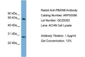 WB Suggested Anti-FBXW8  Antibody Titration: 0. (FBXW8 抗体  (Middle Region))