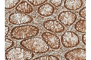 Immunohistochemistry analysis using Rabbit Anti-HSP70 (Acetyl Lys77) Polyclonal Antibody (ABIN5650770).