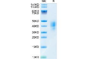 Mouse CD47 on Tris-Bis PAGE under reduced condition. (CD47 Protein (CD47) (AA 19-140) (His tag))