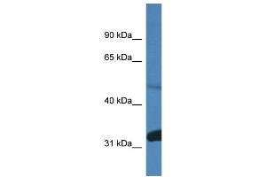 Western Blotting (WB) image for anti-Protein Phosphatase 2, Regulatory Subunit B, delta (PPP2R2D) (C-Term) antibody (ABIN2786544)