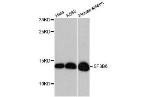 Western blot analysis of extracts of various cell lines, using SF3B6 antibody. (Pre-mRNA Branch Site Protein p14 (SF3B14) (AA 1-125) 抗体)